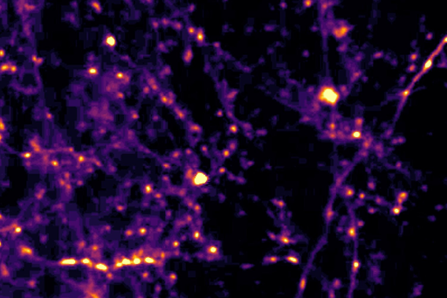 Ilustración microscópica de conexiones neuronales vinculadas con la comparación entre señales sensoriales recientes y presentes.