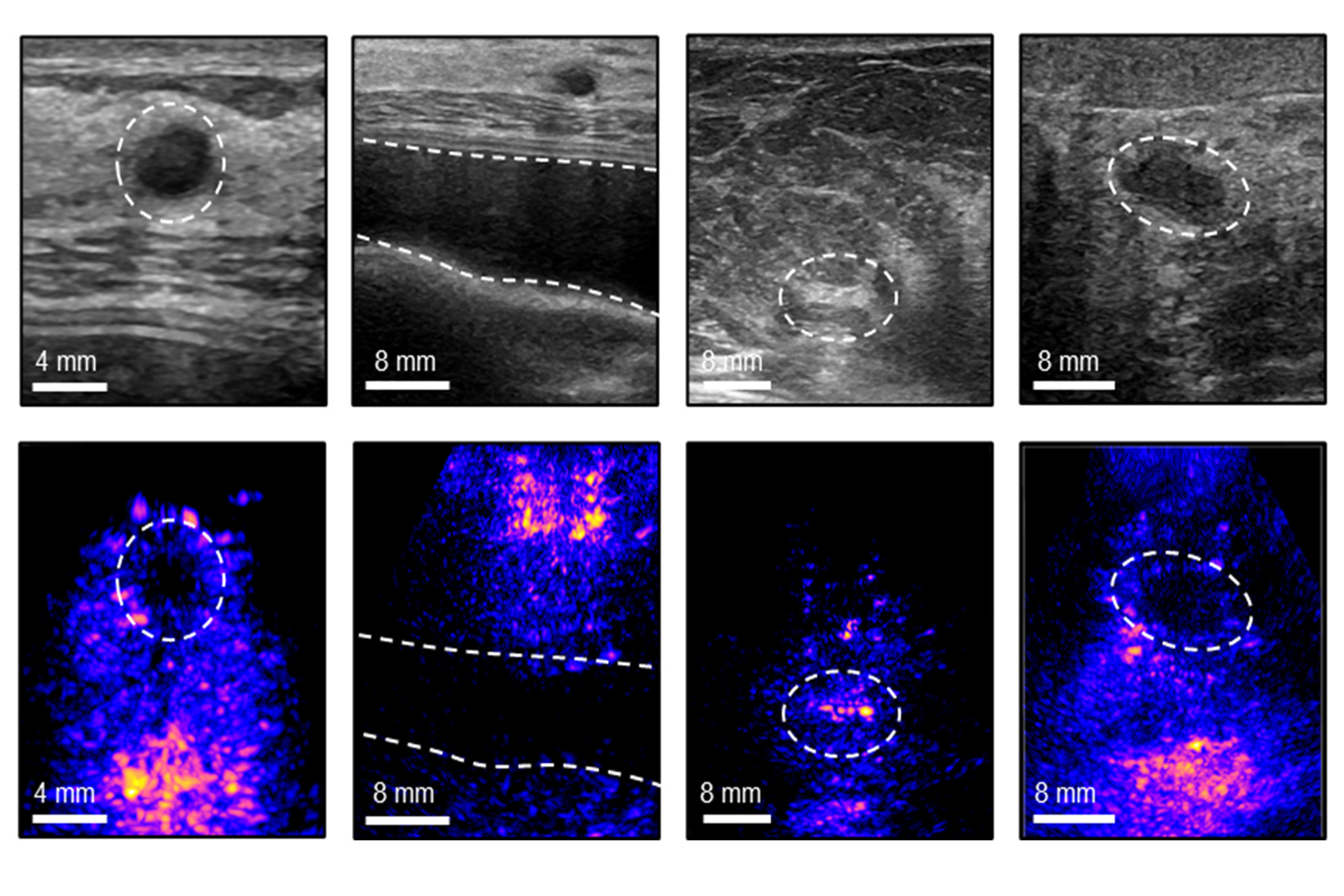 Prototipo portátil de ecografía mamaria tridimensional colocado sobre un modelo de tejido durante una prueba de laboratorio