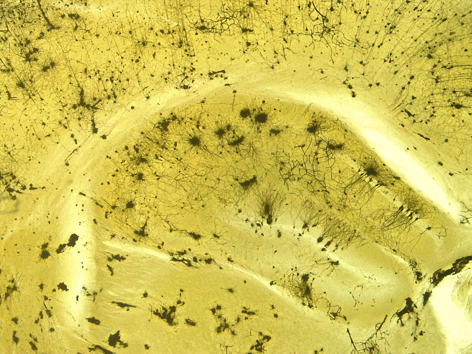 Neuronas del hipocampo teñidas y observadas al microscopio.