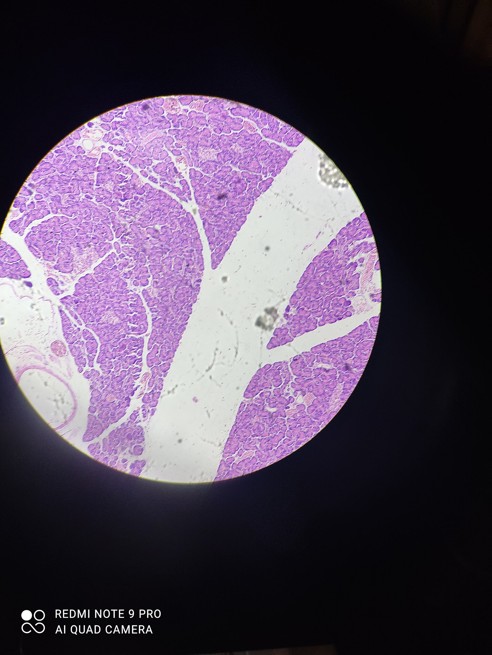 Micrografía histológica de tejido pancreático.