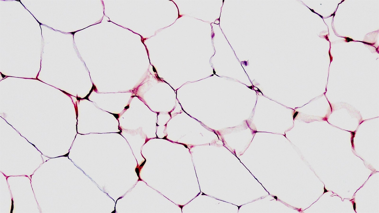 Micrografía de tejido adiposo.