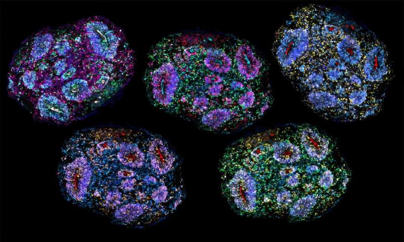 Imágenes de organoides cerebrales humanos cultivados en laboratorio durante varios años