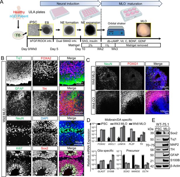 Imágenes de organoides del mesencéfalo humano con marcadores celulares usadas para estudiar la enfermedad de Gaucher neuronopática