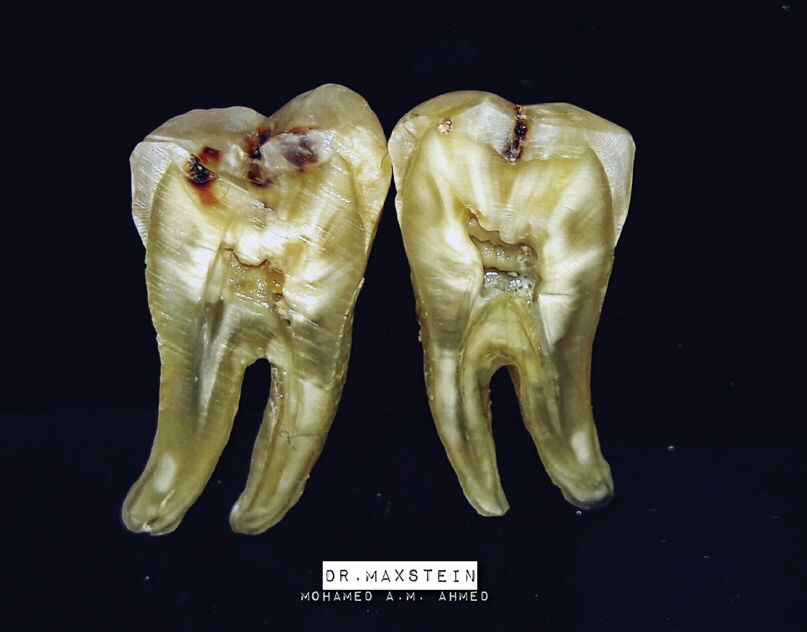 Imagen anatómica macro de una pieza dental humana.