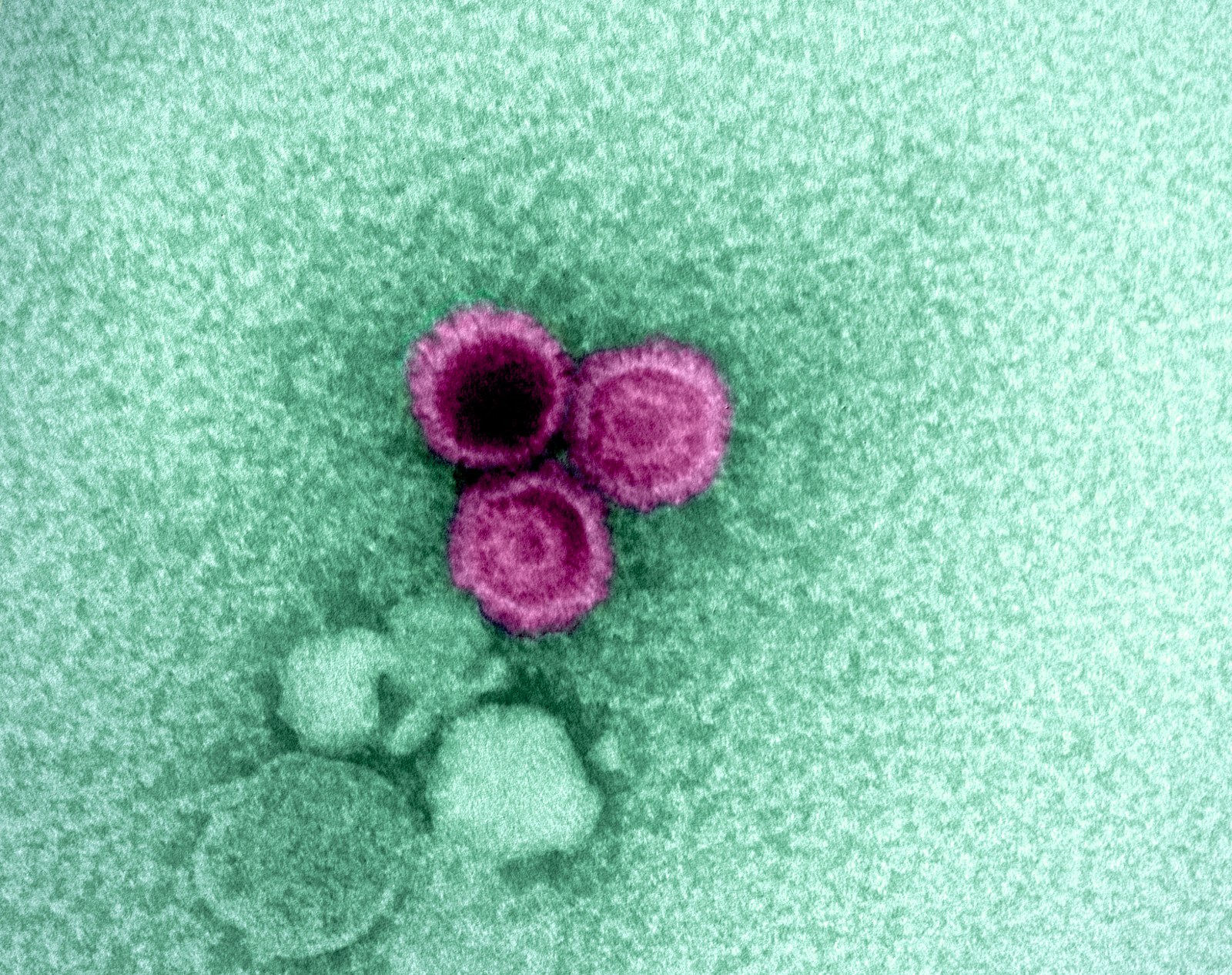 Micrografía electrónica de partículas del virus de Epstein-Barr.
