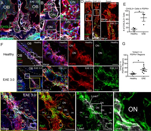 Micrografía del estudio que muestra vasos linfáticos y células inmunitarias alrededor de la placa cribosa, una zona de drenaje situada entre la nariz y el cerebro en ratones